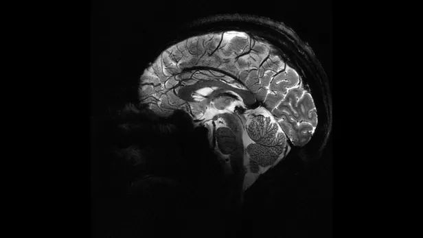 Voici les premières images de cerveau dévoilées par l’IRM la plus puissante du monde Grâce à un aimant hors norme, l’IRM Iseult développée à Paris-Saclay par le CEA permet d’obtenir des clichés dix fois plus précis que ceux disponibles dans les hôpitaux. Jamais un cerveau humain n’a pu être visualisé avec une telle précision. Dans les sous-sols de NeuroSpin, le centre de recherche du CEA à Saclay (Essonne), l’IRM la plus puissante au monde vient d’être testée pour la première fois sur un être humain et les premières images sont exceptionnelles